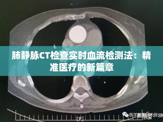 肺静脉CT检查实时血流检测法:精准医疗的新篇章