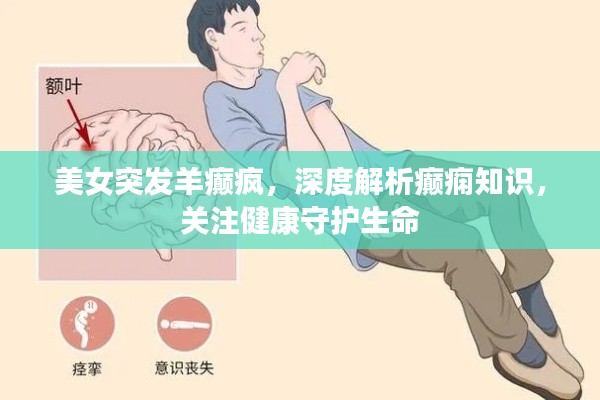 美女突发羊癫疯，深度解析癫痫知识，关注健康守护生命