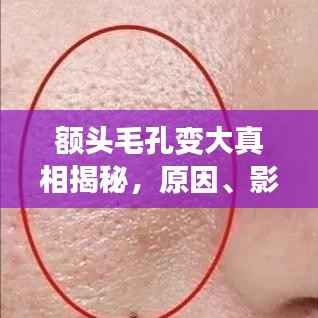额头毛孔变大真相揭秘，原因、影响及改善方法全解析