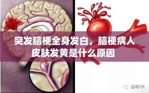 突发脑梗全身发白，脑梗病人皮肤发黄是什么原因 
