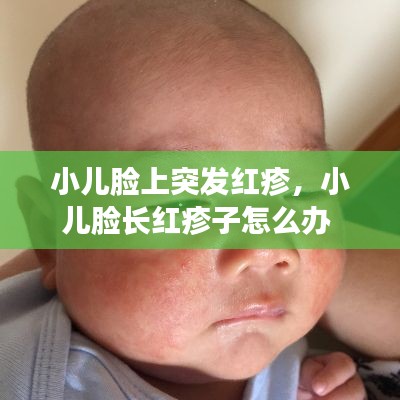 小儿脸上突发红疹,小儿脸长红疹子怎么办