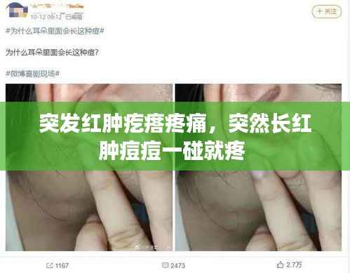 突发红肿疙瘩疼痛,突然长红肿痘痘一碰就疼