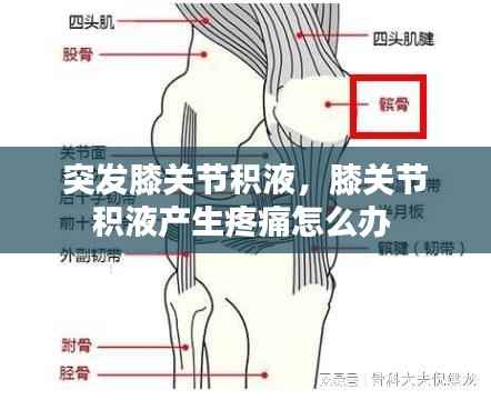 突发膝关节积液，膝关节积液产生疼痛怎么办 