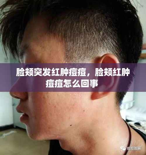 脸颊突发红肿痘痘,脸颊红肿痘痘怎么回事