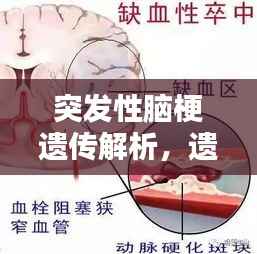 突发性脑梗遗传解析，遗传与脑梗有何关联？