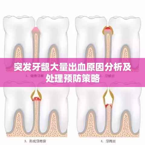 突发牙龈大量出血原因分析及处理预防策略