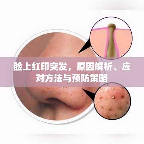 脸上红印突发，原因解析、应对方法与预防策略